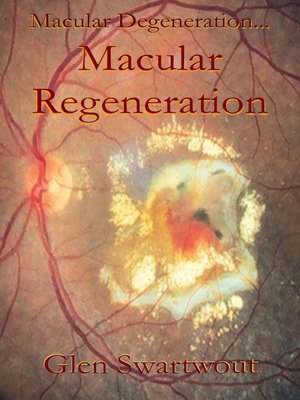 cover image of Macular Degeneration... ...Macular Regeneration